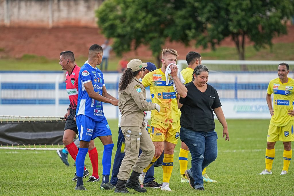 Jogador do DAC passa por cirurgia no rosto e fica fora do time